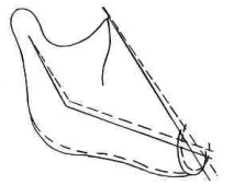 Manual Illustration